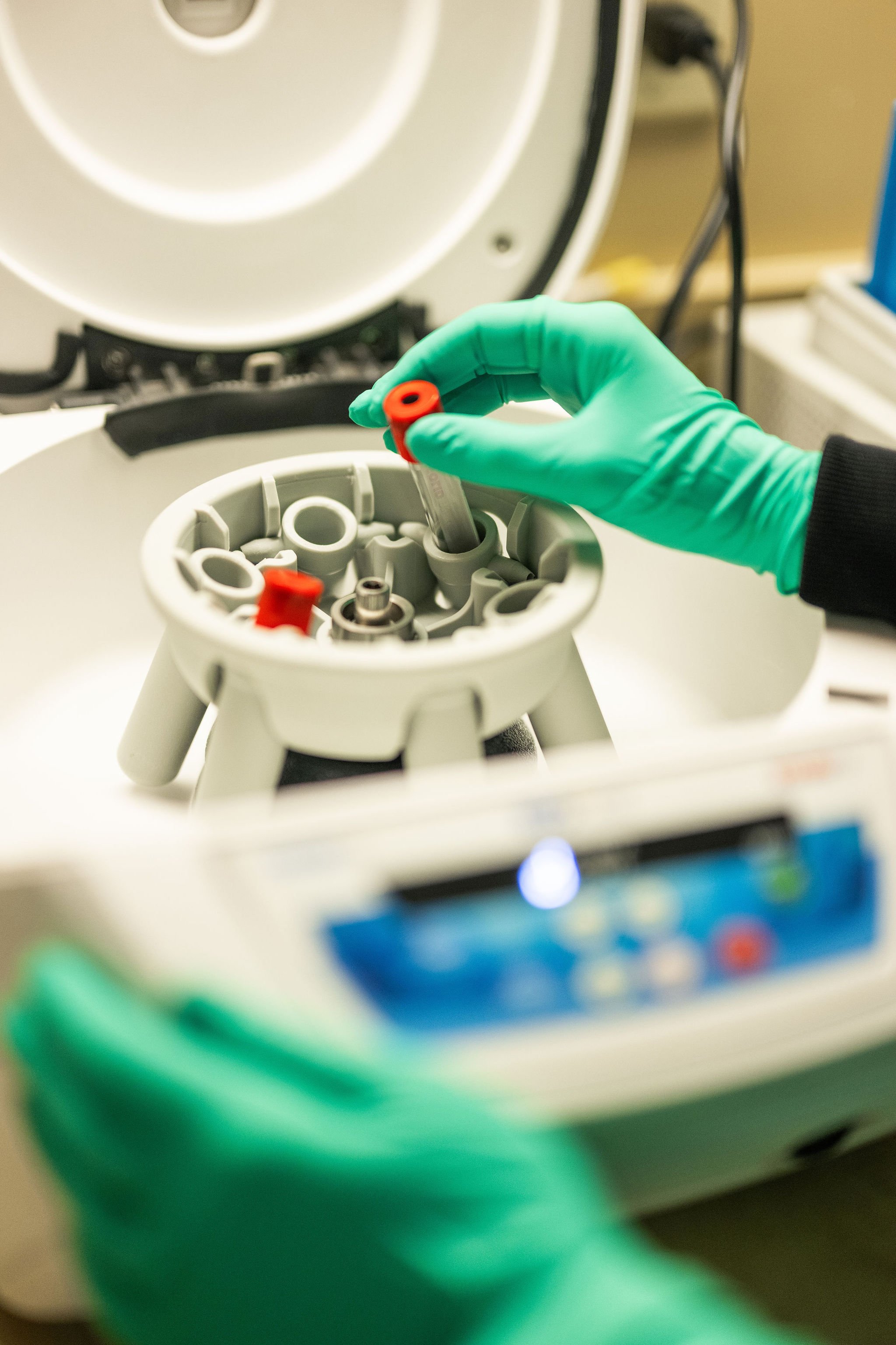 Dr. Haigney explaining platelet rich plasma procedure | Lake Norman Oral & Facial Surgery, Huntersville, NC